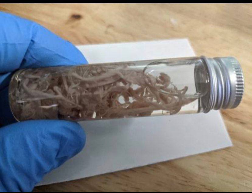 SCHLANGENGIFTimpfmorde weltweit
                            14.6.2022: T�dliche, gummiartige
                            Blutgerinnsel gefunden