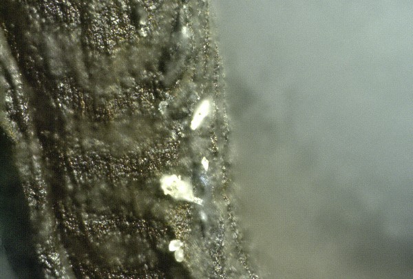 Braunes
                    Blutgerinnsel 08