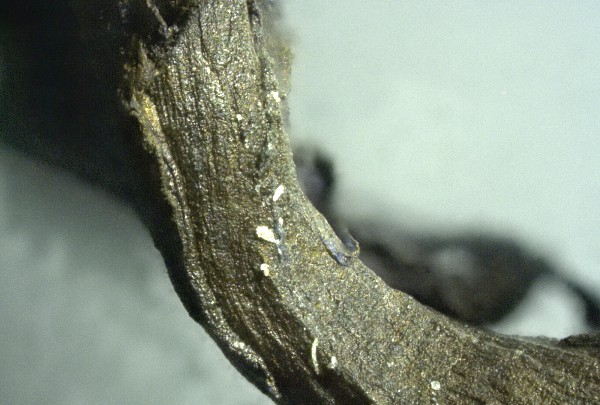 Braunes
                    Blutgerinnsel 07