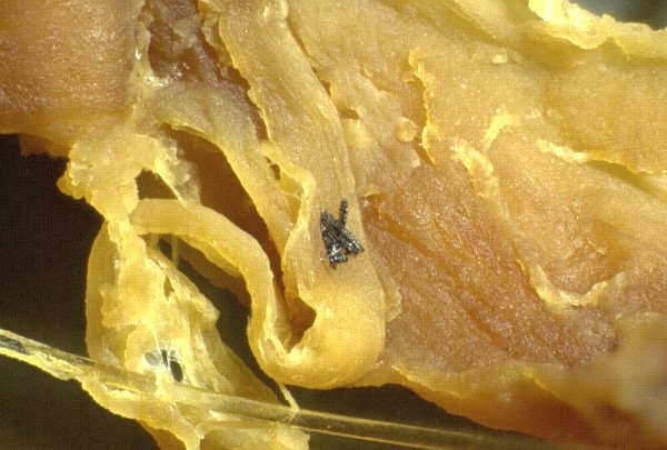 Gelbes
                    Blutgerinnsel 02