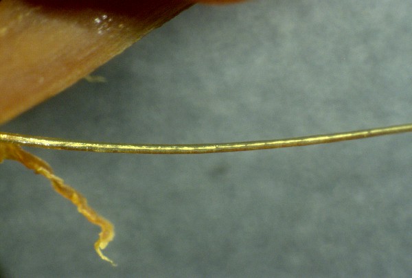 Oranges Blutgerinnsel mit Draht 02