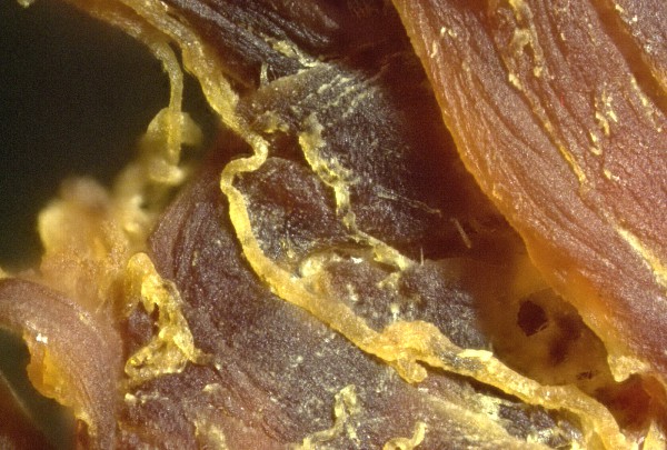 Braunrotes
                    Blutgerinnsel 02