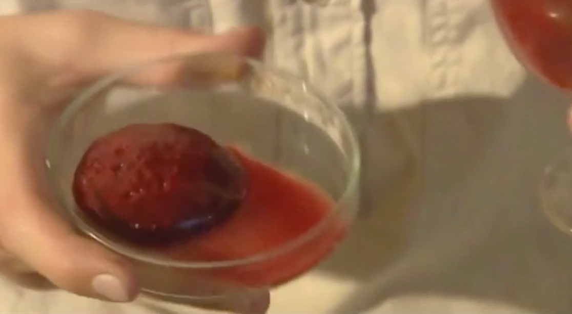 Video:
                  SCHLANGENGIFT provoziert BLUTGERINNSEL - SNAKE VENOM
                  provokes BLOOD CLUTS (31'')