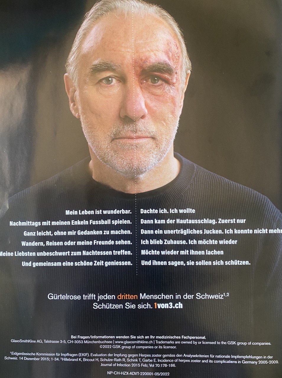 SCHLANGENGIFTimpfschaden
                  Schweiz 15.7.2022: G�rtelrose im Gesicht