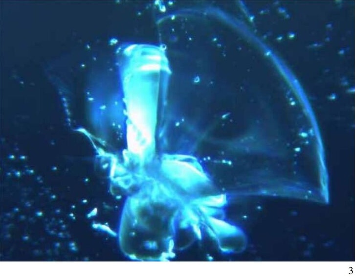 Pfizer-Impfung in Italien: Die Partikel im
                      Blut gruppieren sich in kristalliner Form