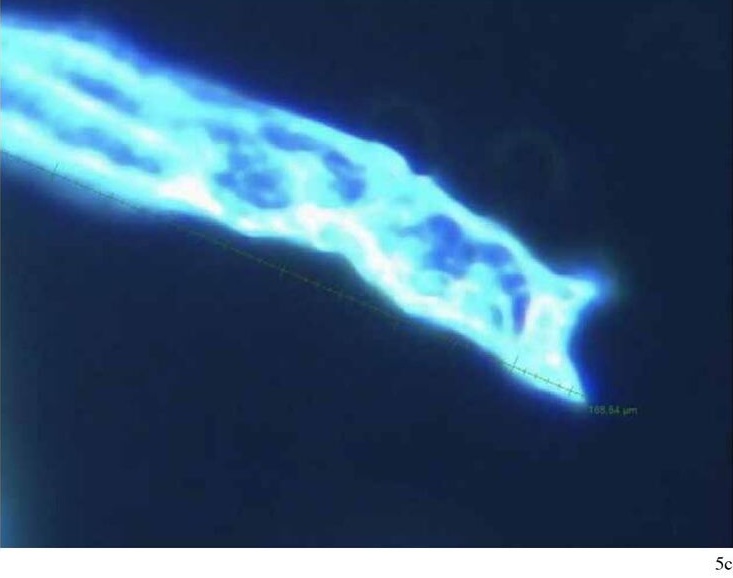 Mann mit Pfizer hat Blutschaden:
                      faserartig+r�hrenf�rmige Strukturen im Blut, Fotos
                      5c