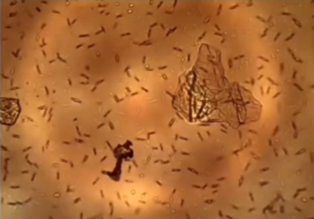 Dr.
                Philippe van Welbergen: Graphen im Dunkelfeldmikroskop
                im Blut (Vergr�sserung)