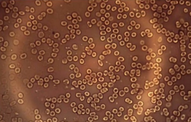 Dr. Philippe van Welbergen:
                normales Blut im Dunkelfeldmikroskop