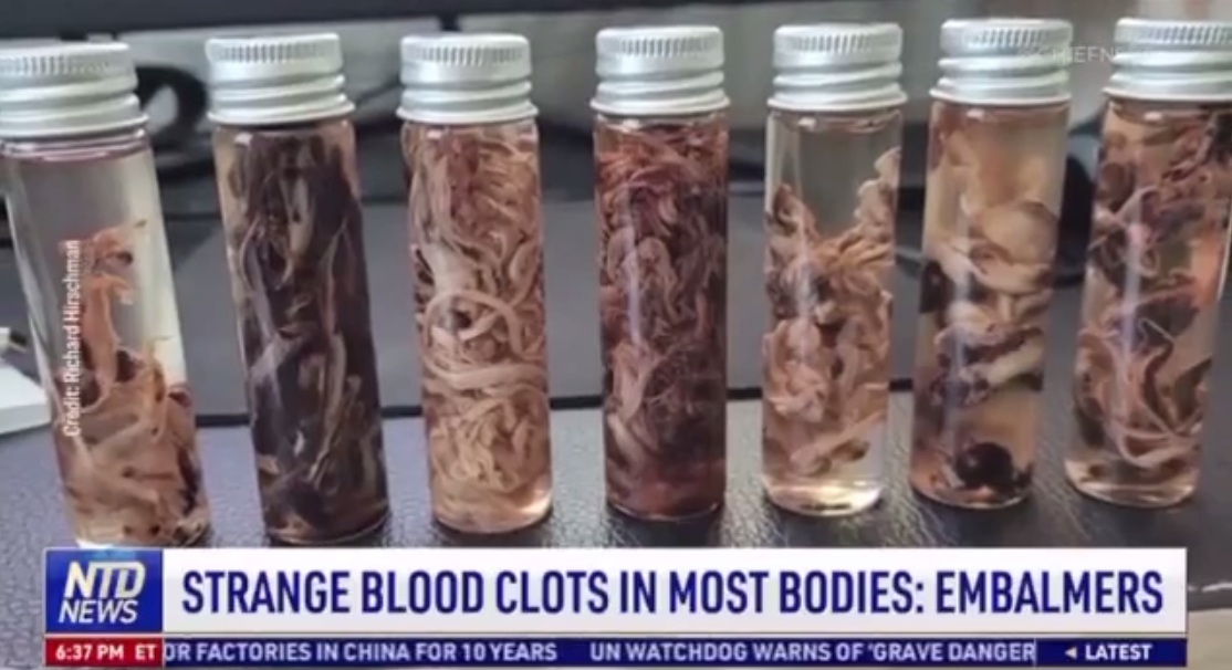 NTD News 13.9.2022:
                    Faserblutgerinnsel von Einbalsamierer Hirschman