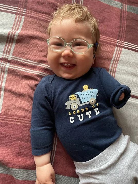 Missbildung in Wuhan
                  28.9.2022: Geimpfte Mutter hat Baby mit
                  Hirnschaden+Thrombose im Arm, Arm amputiert + Kr�mpfe:
                  Newborn baby’s arm AMPUTATED after mom took covid
                  vaccines and baby suffered blood clots in the womb