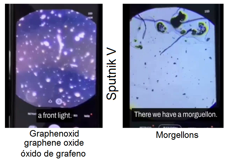 Inhaltsstoffe von Sputnik V am 9.10.2022:
                  Graphenoxid, Morgellons etc. - Putin t�tet auch mit
                  Impfung: Dr. Liliana Zelada deckt auf: GRAPHEN,
                  MORGELLONS, NANOTECHNOLOGIE IM SPUTNIK IMPFSTOFF ‼️