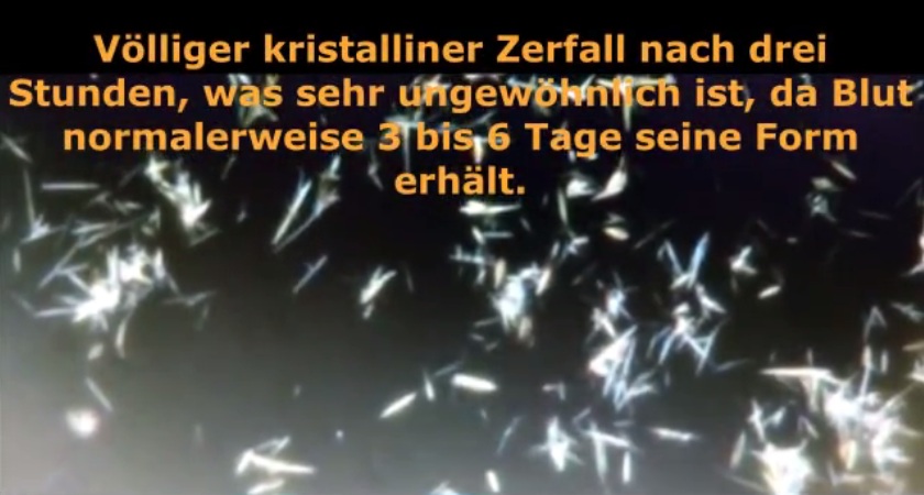 Blutschaden durch "Coronaimpfung"
                    25.10.2022: Mann (50) 3x Pfizer/BionTech
                    geimpft+Krebs: Blut zerf�llt in 3 Stunden