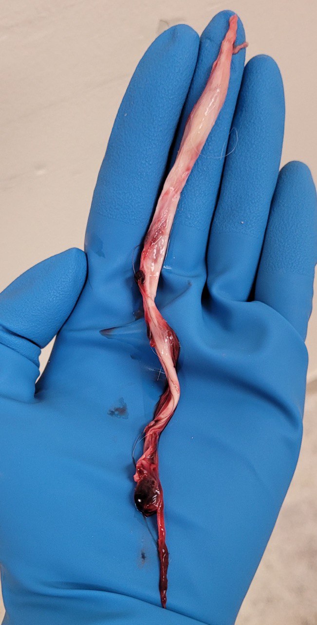 27.10.2022: Einbalsamiererin Jennifer E. Steps
                    pr�sentiert ein Faserblutgerinnsel