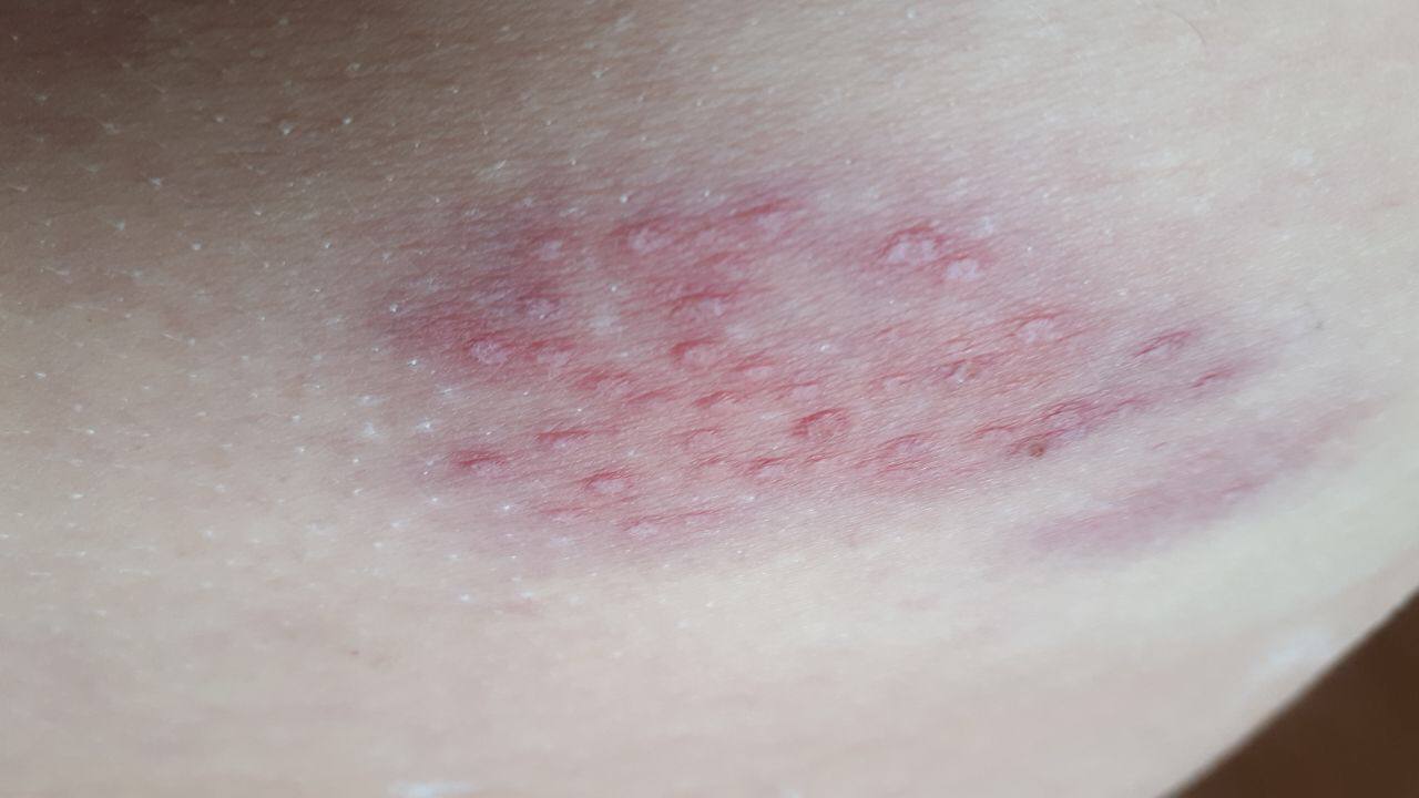 Shedding Schweiz
                        24.10.2022: zum Beispiel eine kleine G�rtelrose