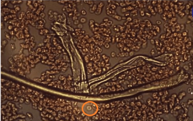 Blut mit
                      Shedding 01