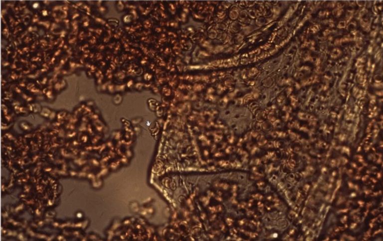 Blut mit
                      Shedding 02