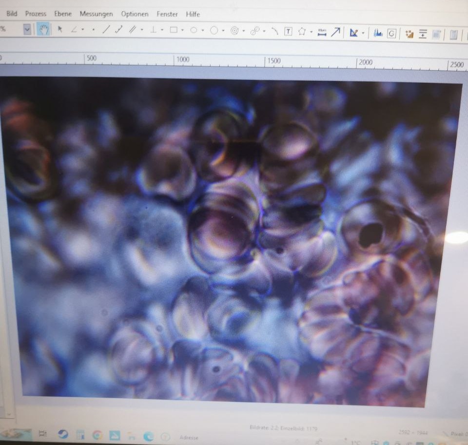 7.12.2022: Gesundes UNgeimpftes
                    Blut 100x vergr�ssert