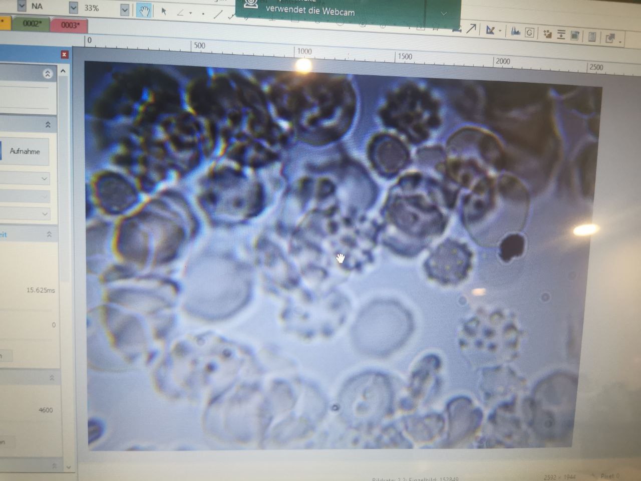 7.12.2022: krankes, geimpftes Blut
                    100x vergr�ssert