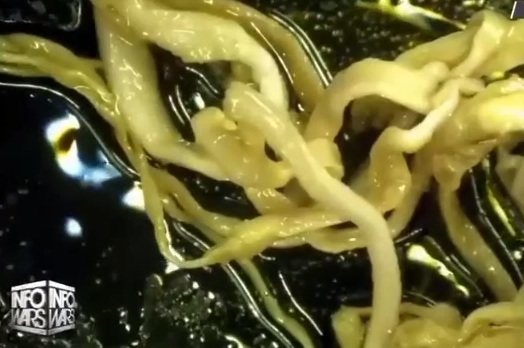 INFO WARS am 8..2024:
                                            Weisse Faserblutgerinnsel im
                                            gewaschenen Blut von
                                            "Corona"-Geimpften:
                                            Das ist in den Geimpften…