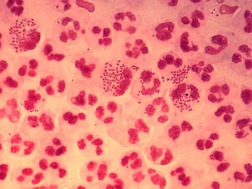 Mikroben (hier: neisseria gonorrhoeae)
                          können Antigene nachahmen und so die
                          Immunsysteme überlisten, wenn die Ernährung
                          nicht der Blutgruppe entspricht