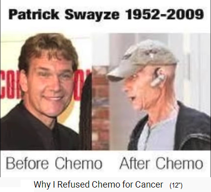 Patrick Swayze, Chemotherapie-Opfer vor
                            und nach der Chemotherapie 1952-2009