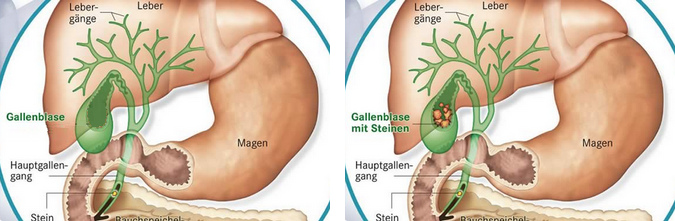 H�gado, bilis y ves�cula, esquema