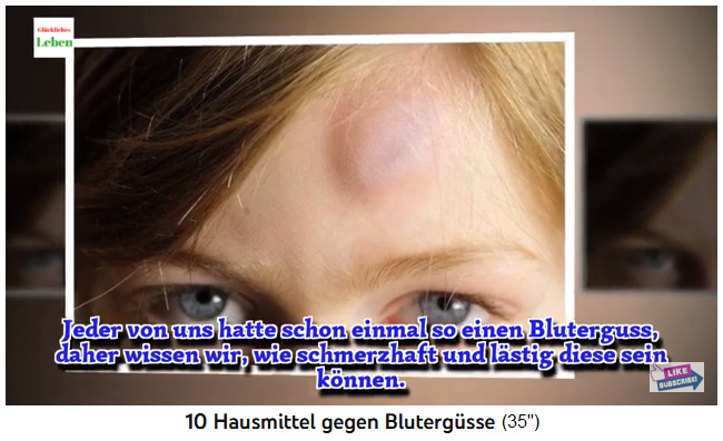 Blauer Fleck mit Beule an der Stirn