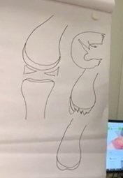 Dr.
                                  Volker Stoll: Der gezackte Knorpel
                                  wird gegl�ttet