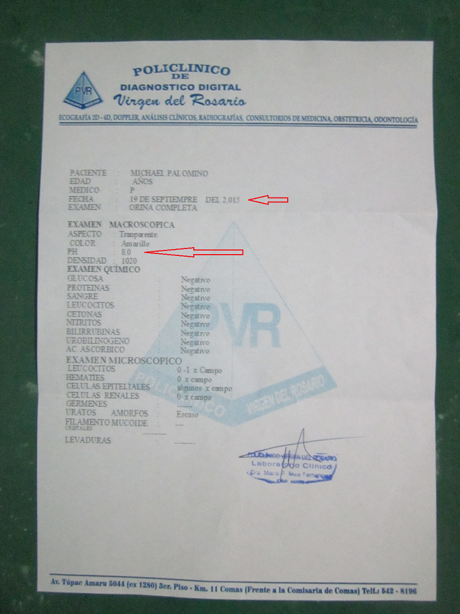 La prueba de mi valor pH del 19 de
septiembre con un valor pH de 8 en la orina La prueba de mi valor pH del 19 de
septiembre con un valor pH de 8 en la orina