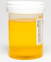 Urinprobe
