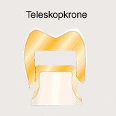 Krone: Die Teleskopkrone ist die
                              Krone fr den Backenzahn oder Mahlzahn,
                              mit einem unteren und einem oberen Teil
                              ("Doppelkrone") [35].