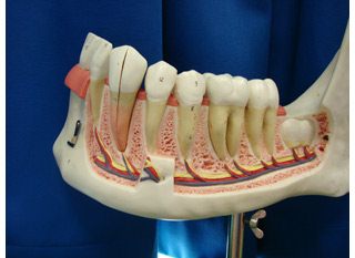 Der offene
                        Unterkiefer im Modell zeigt, wie weit die Zhne
                        im Kiefer verwurzelt sind. Auf dem Kiefer sitzt
                        das Zahnfleisch.