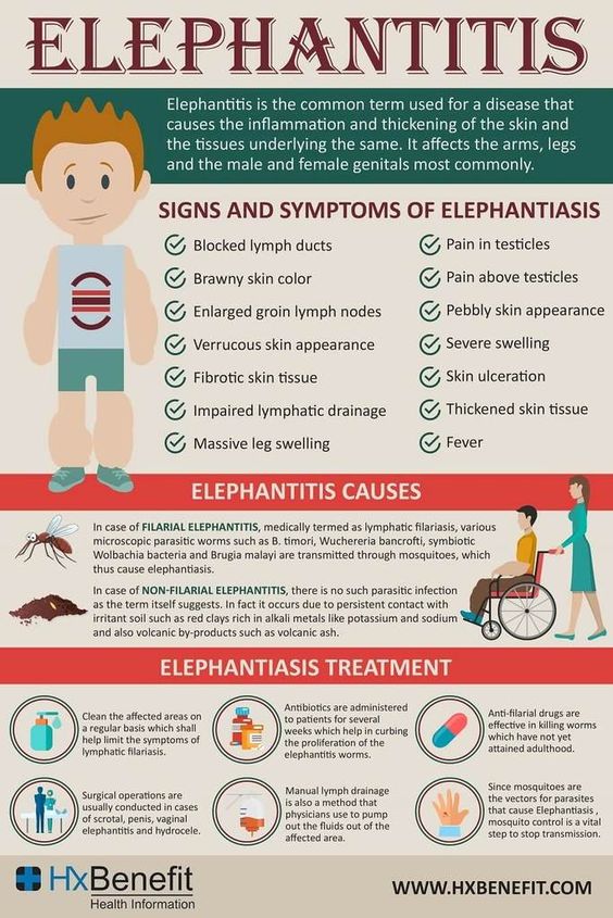 Elephantiasis, Liste der Ursachen und
                  Symptome (englisch)