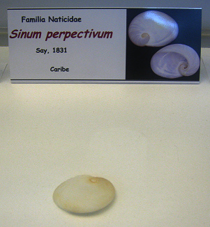 Sinum perpectivum