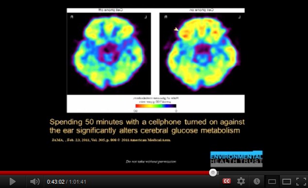 50 Minuten
              Handy am Ohr bewirkt viel aktiveren Glukose-Stoffwechsel
              im Gehirn