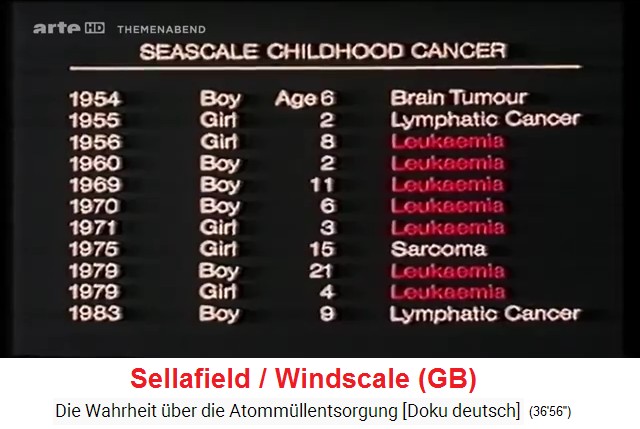 Region Sellafield: Kinder mit Blutkrebs Leukämie,
                  eine Liste im GB-TV 1980er Jahre