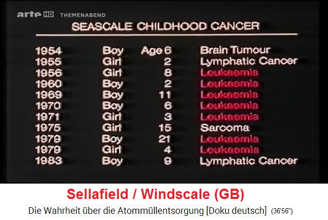 Sellafield
                  region: children with blood cancer leukemia, a list on
                  GB-TV 1980s
