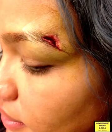 Diddy schl�gt Cassie Ventura
                        01: tiefe Wunde am Auge