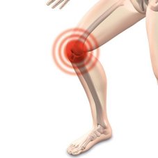 Knie
                        schmerzt, Schema