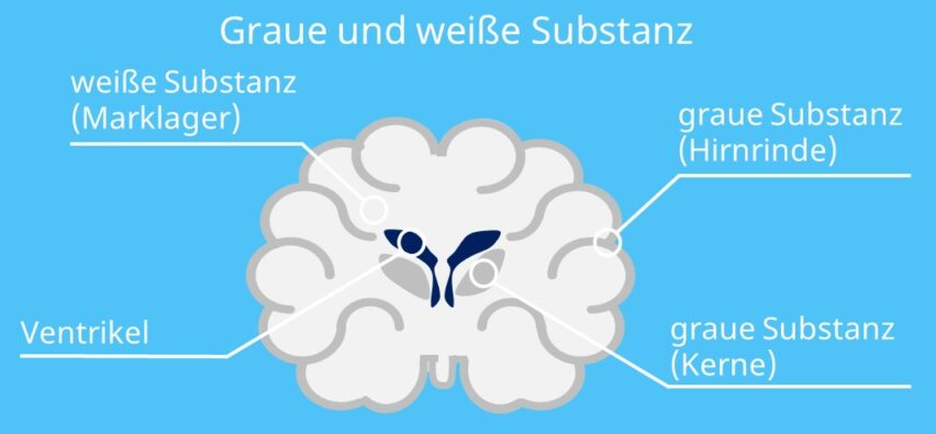 Schema Hirn Aufteilung: graue und weisse
Substanz Schema Hirn Aufteilung: graue und
weisse Substanz