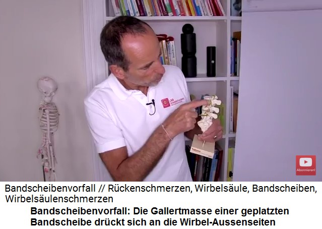 Die Gallertmasse der
                      geplatzten Bandscheibe dr�ckt sich an die
                      Wirbel-Aussenseiten