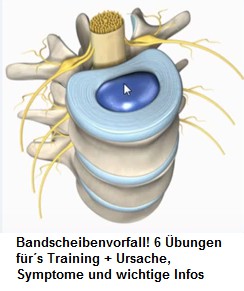 Bandscheibe mit Faserring und
                                      Gallertkern, Schema