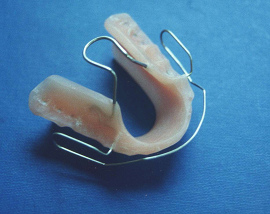 Die Kieferspange
                                "Bionator" kann bei zu kleinem
                                Kiefer im Schulalter angewandt werden