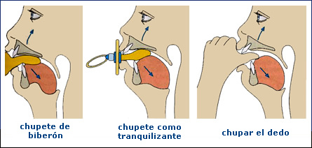 Malformaci�n dentaria por demasiado chupar
                        a biberones (chupete de biber�n), chupetes
                        (chupetes de tranquilizaci�n) y por chupar
                        demasiado el dedo [5]: Los primeros dientes
                        incisivos van ser levantado [8].