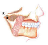 Z�hne zusammenbeissen in
                            Stresssituationen ist absolut sch�dlich.
                            Z�hne zusammenbeissen ist �berhaupt nur
                            sch�dlich, denn die Kieferknochen meinen
                            dann, sie m�ssten sich zur�ckziehen, und
                            dann geht auch das Zahnfleisch zur�ck, und
                            hat mit Konzentration nichts zu tun [7].