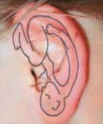 Auriculoterapia y acupresi�n de la oreja: hay un
              bebe en la oreja