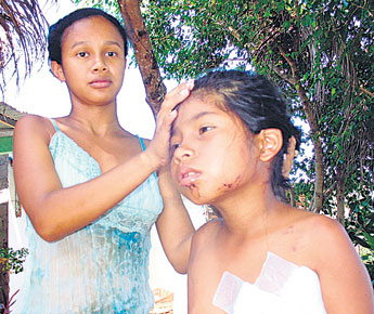 Verletzungen am ganzen K�rper durch 4
                        Wachhunde