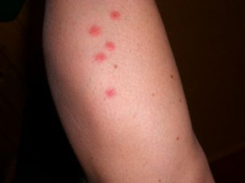 ... mordi� mucho a un
                      hombre ...