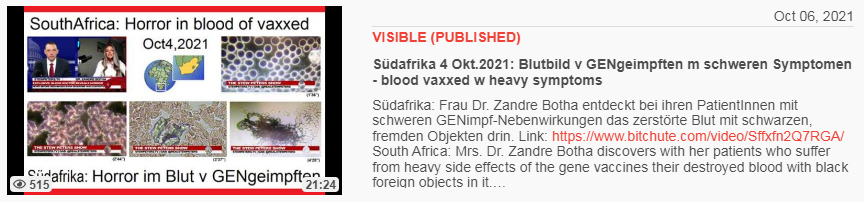"Corona"-Impfschaden in S�dafrika: Frau
                Dr. Botha pr�sentiert den Blutschaden von
                "Corona"-Geimpften: Im Mikroskop sieht man die
                zerst�rten Blutk�rperchen, Fotos